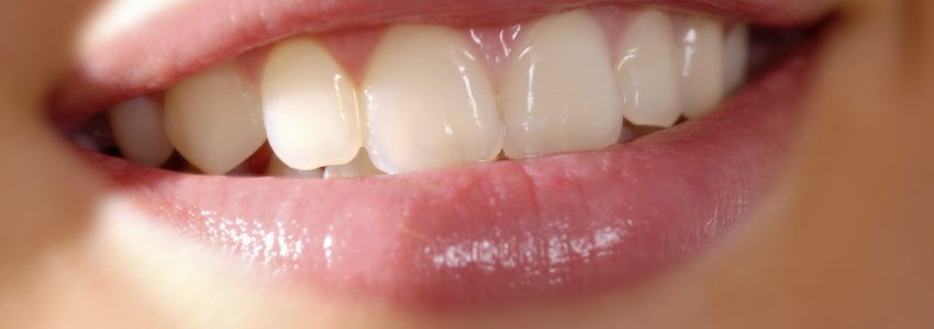 Unlocking Your Best Smile: The Wonders of Teeth Whitening Strips